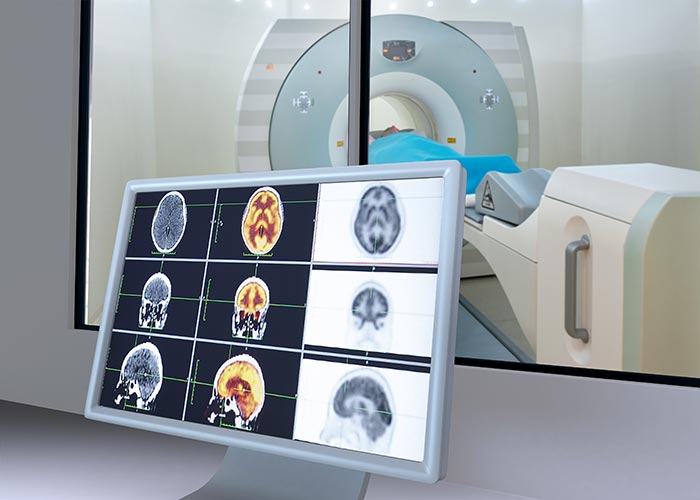 Big-Happenings-in-Medical-Imaging-Suggest-Better-Treatment-Options-700x500