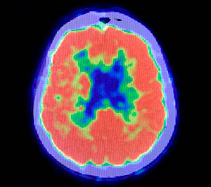 Molecular-Imaging-productIMG-300x265